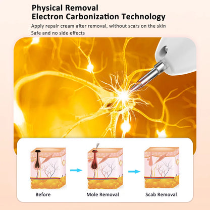 Plasma Cosmetic Spot Remover Pen Adjustable